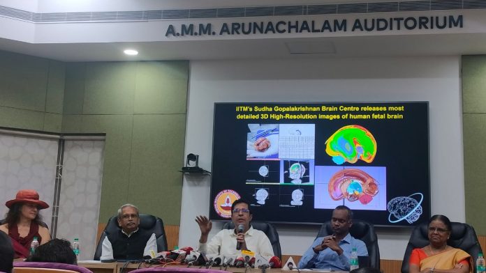 கருவின் மூளையின் மிக விரிவான, முப்பரிமாண உயர் தெளிவுத்திறன் படங்களை உருவாக்கிய உலகின் முதல் ஆராய்ச்சி அமைப்பாக ஐ. ஐ. டி மெட்ராஸ் செவ்வாய்க்கிழமை ஆனது | அனீசா பி. ஏ | திபிரிண்ட்